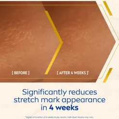 Nivea Luminous630 Body Oil-Serum Anti Stretch Marks 100 ml