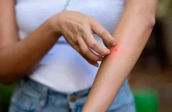 Terraillon Afvisende midler mod insektbid Insect Calm